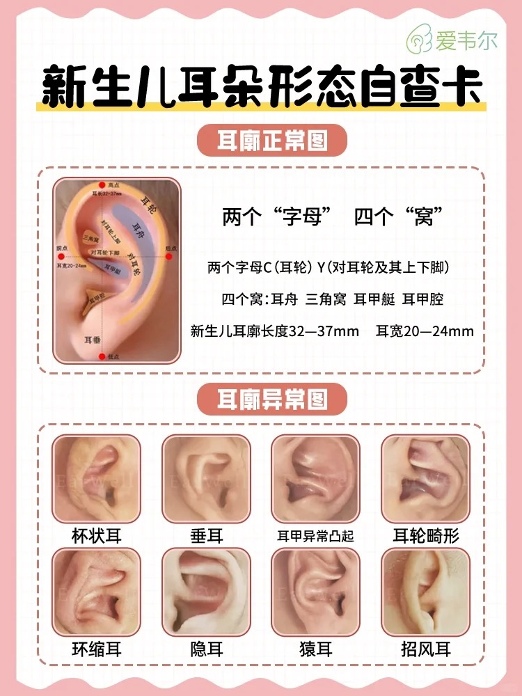 新生儿耳朵形态自查：快来get这份实用攻略！_1_EarWell爱韦尔_来自小红书网页版.jpg