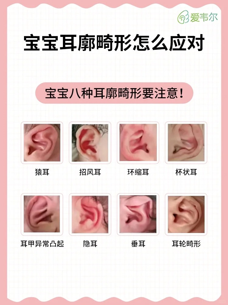 新手爸妈必看，发现宝宝耳廓畸形怎么应对？_1_EarWell爱韦尔_来自小红书网页版.jpg